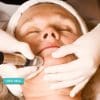 Microdermabrasion Six-Session Package