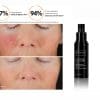 Correcting Complex 30% from Danik MedSpa