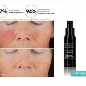 Correcting Complex 30% from Danik MedSpa