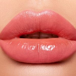 Dermal Filler