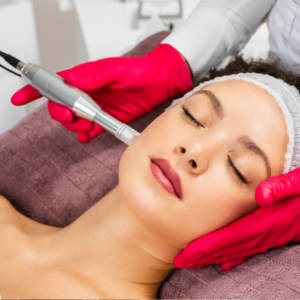 Microneedling Facial + Free PRP Face Treatment