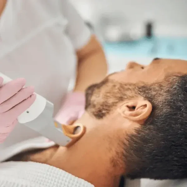 Man receiving laser treatment for beard shaping.