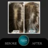 Capillus Laser Hair Restoration + Free PRP Growth Booster – For Women! - Image 2