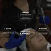 Glow Renewed: PRP Microneedling Magic - Image 2