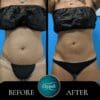 Tirzepatide Weight Loss + B12 Boost for Faster Results - Image 2