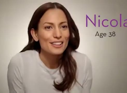 Botox Cosmetic Patient - Nicola 1