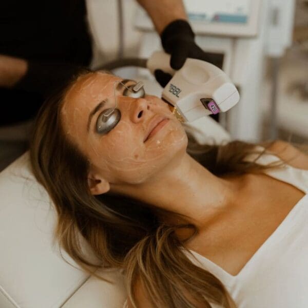 IPL Facial Rejuvenation