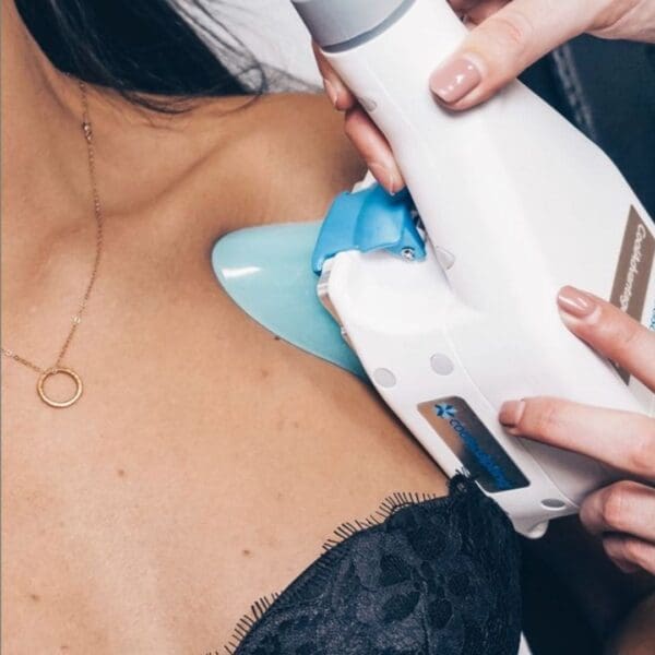 CoolSculpting for Bra Rolls