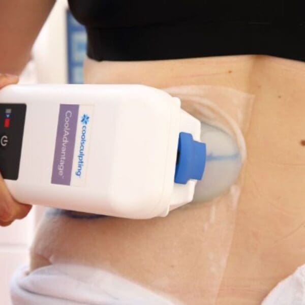 CoolSculpting for Lower Back