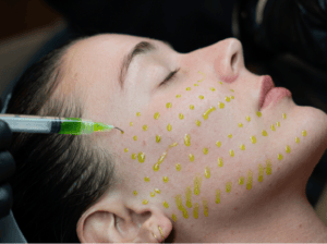 BioRePeel – Skin Renewal Peel