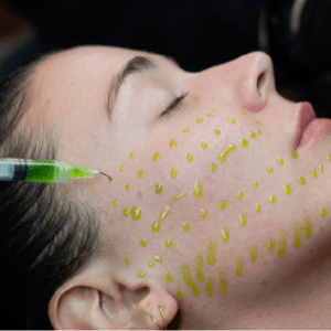 BioRePeel – Skin Renewal Peel