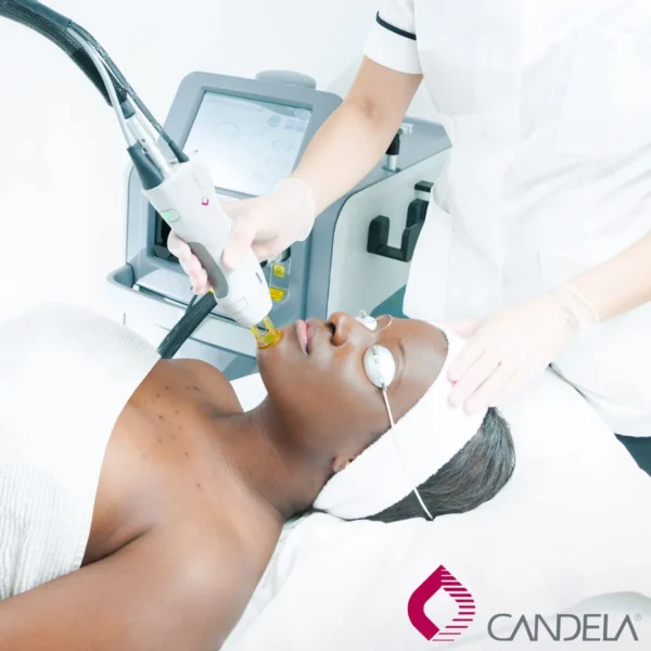Freedom from Hair – Laser Promo