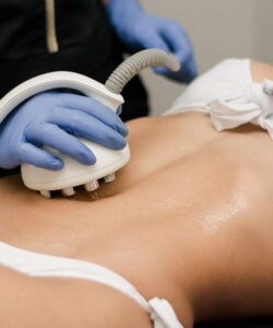 Venus Legacy and Shockwave for Stubborn Belly Fat