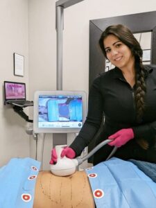 UltraShape®