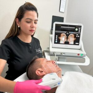 Ultherapy Facelift